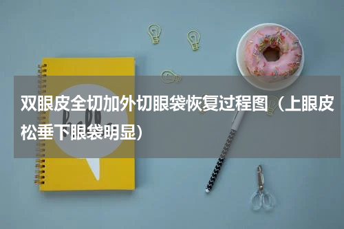 双眼皮全切加外切眼袋恢复过程图（上眼皮松垂下眼袋明显）