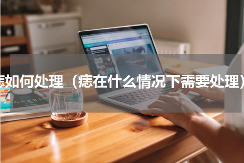 痣如何处理（痣在什么情况下需要处理）