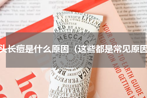 额头长痘是什么原因（这些都是常见原因）